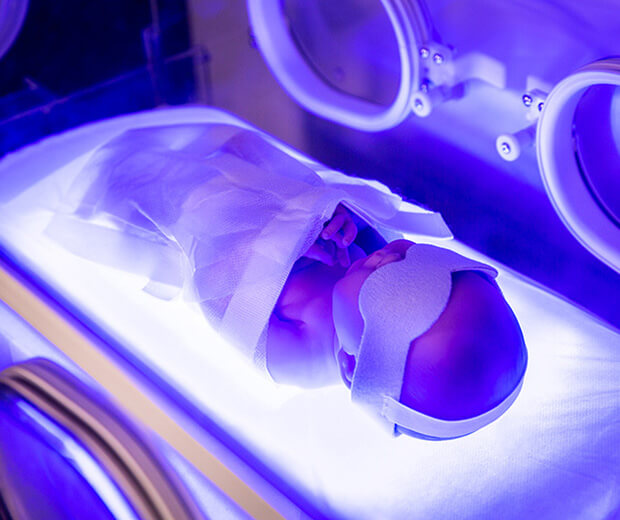 نوزاد در دستگاه فوتوتراپی