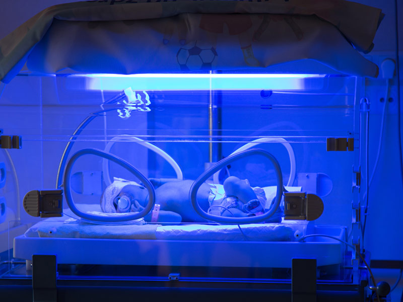 نوزاد در دستگاه فتوتراپی برای کاهش زردی