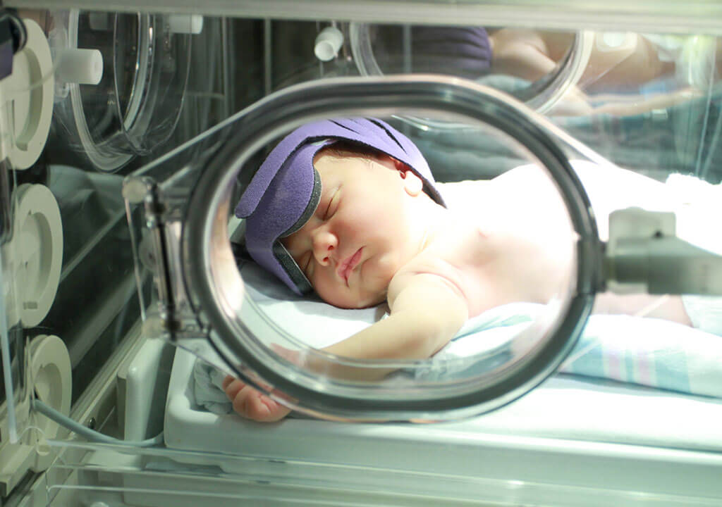 درمان زردی نوزاد با قطره بیلی ناستر