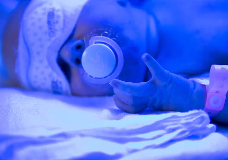 کودک مبتلا به بیماری زردی در دستگاه فتوتراپی