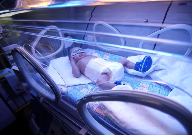 نوزاد مبتلا به زردی در دستگاه فتوتراپی