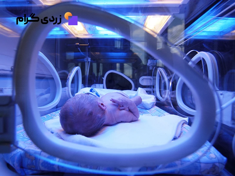 نوزاد مبتلا به زردی تحت درمان در دستگاه زردی نوزاد